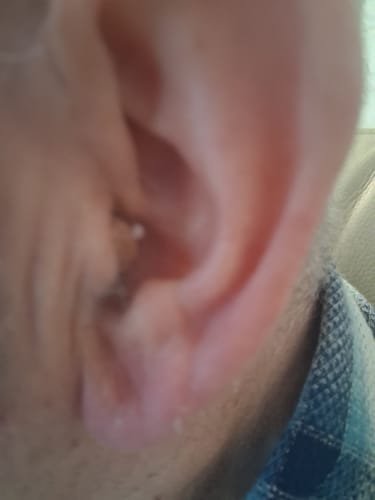 Customer photo review of Modern Hearing Comfort Hearing Aids