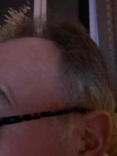 Customer photo review of Modern Hearing Comfort Hearing Aids